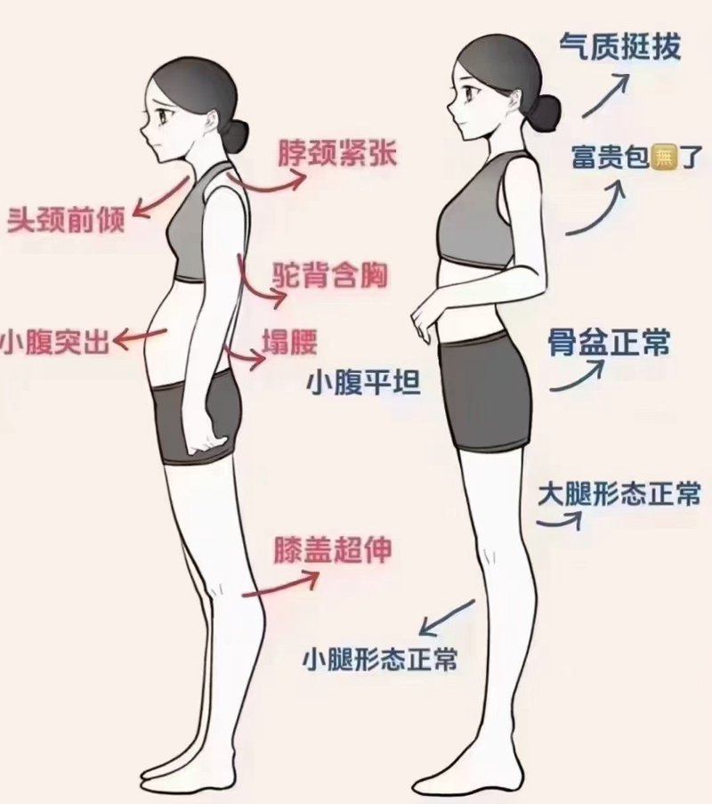 体态矫正